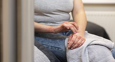 Bu hastalık kadınlarda 9 kat fazla görülüyor